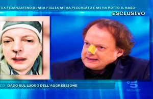 dado_pellegrini_aggressione rettifica
