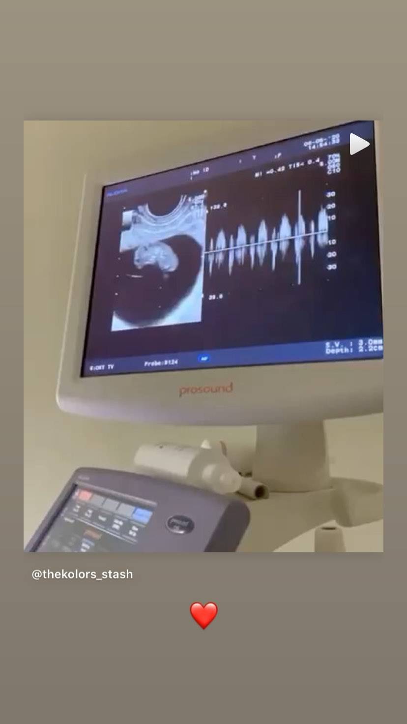 Giulia Belmonte fidanzata Stash