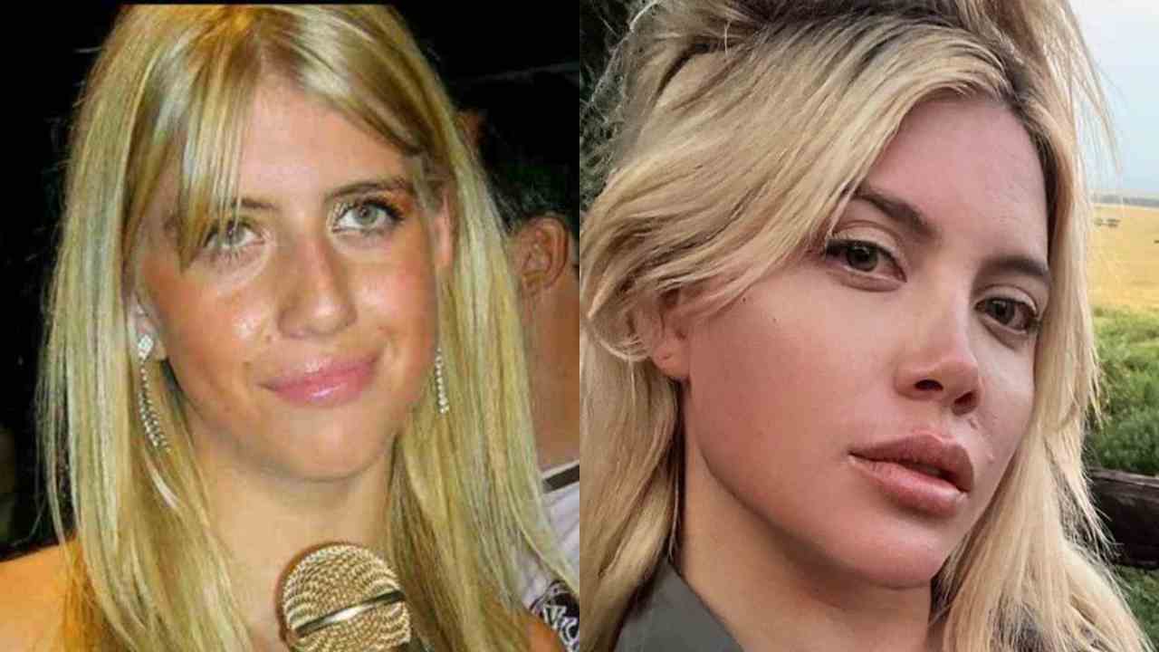 Wanda Nara prima e dopo